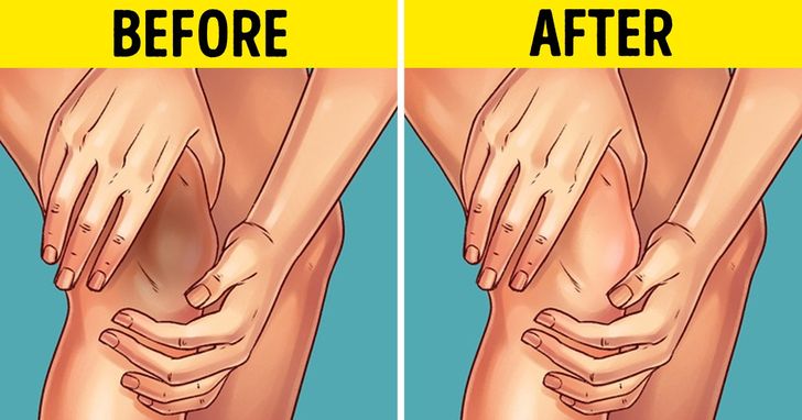 Say Goodbye to Dark Knees and Elbows with These Proven Solutions