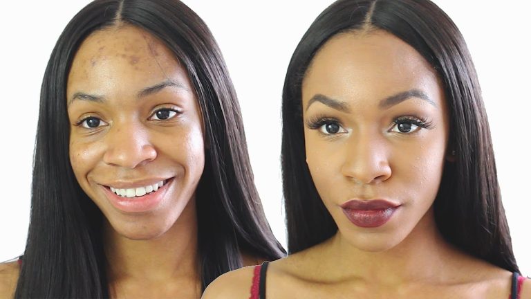 Illuminate Your Skin: Aloe Vera for Fading Dark Spots