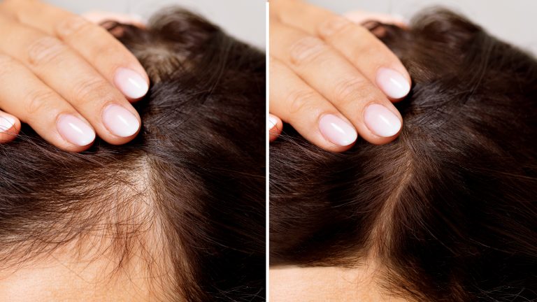 Unleash Your Hair Growth Potential with These Powerful Tips