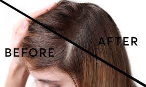 5 Effective Hair Thickening Remedies