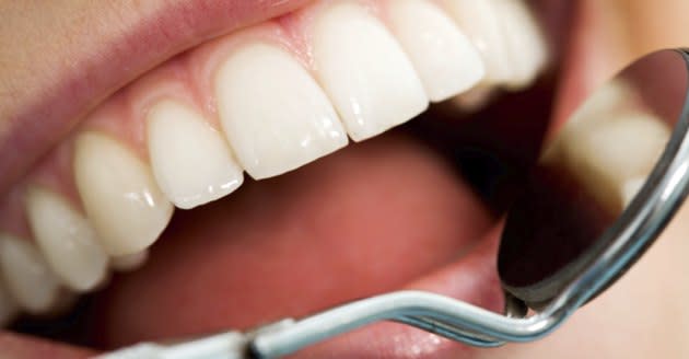 Say Goodbye to Cavities: How to Protect Your Teeth Naturally