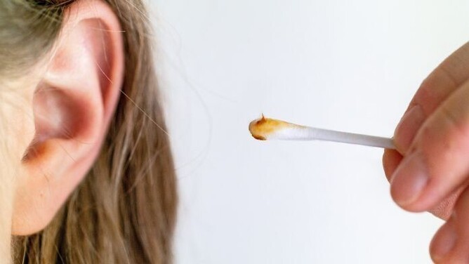 Safely Clean Earwax Without Worries